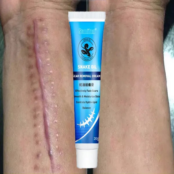 Crema reparadora de cicatrices con aceite de serpiente.