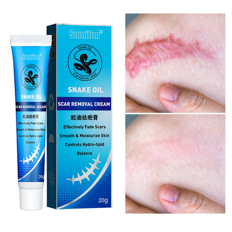 Crema reparadora de cicatrices con aceite de serpiente.