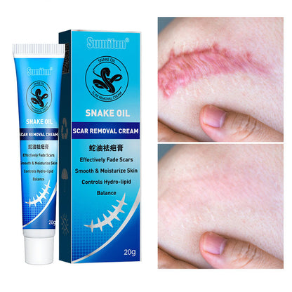Crema reparadora de cicatrices con aceite de serpiente.