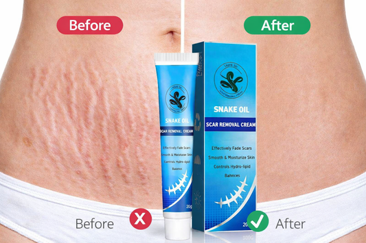 Crema reparadora de cicatrices con aceite de serpiente.